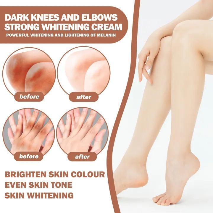 Eelhoe Knees and Elbows Whitening Cream - 50g - Pinoyhyper