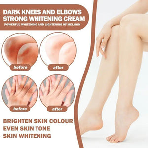 Eelhoe Knees and Elbows Whitening Cream - 50g - Pinoyhyper