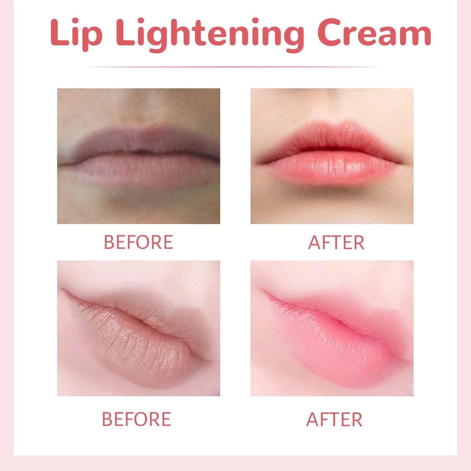 Eelhoe Lip Lightening Cream - 30g - Pinoyhyper