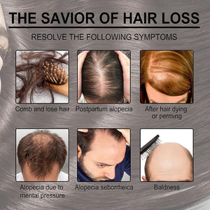 EELHOE Rosemary Oil for Hair Growth - Pinoyhyper