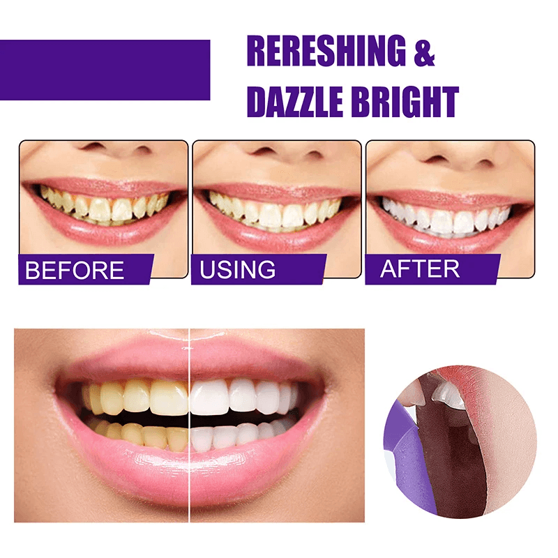 Jaysuing Teeth Whitening Mousse - 50ml - Pinoyhyper
