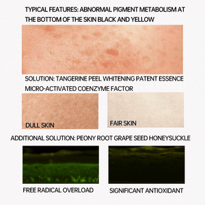 Pei Mei Pink Essence For Lips,Areolas & Private Parts - 30g - Pinoyhyper