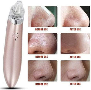 Portable Ultrasonic XN-8030 Electric Blackhead Vacuum Cleaner - Pinoyhyper