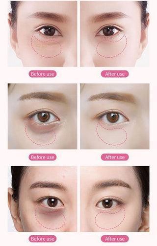 Rose Berry Roselle Gel Eye Mask - 60pcs - Pinoyhyper