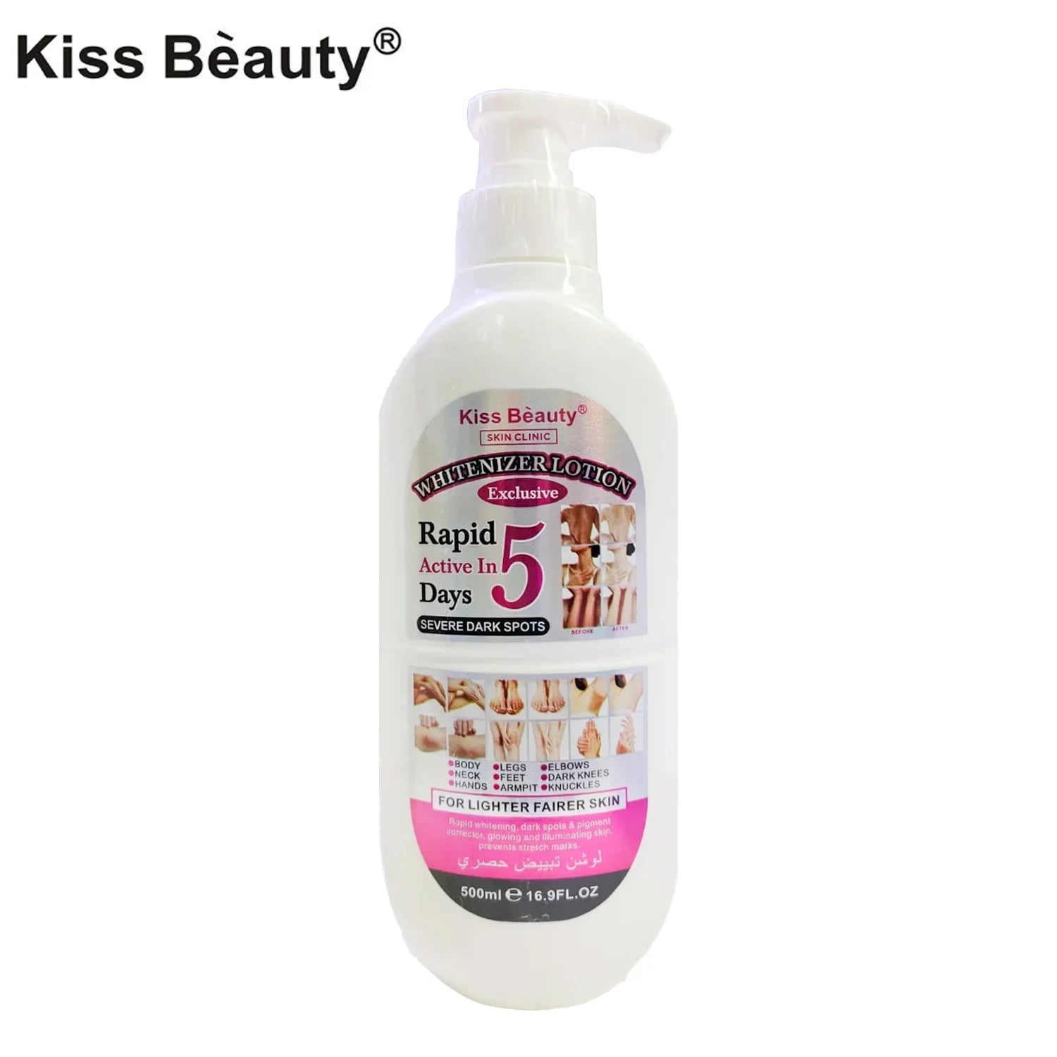 Kiss Beauty Whitenizer Lotion - 500ml