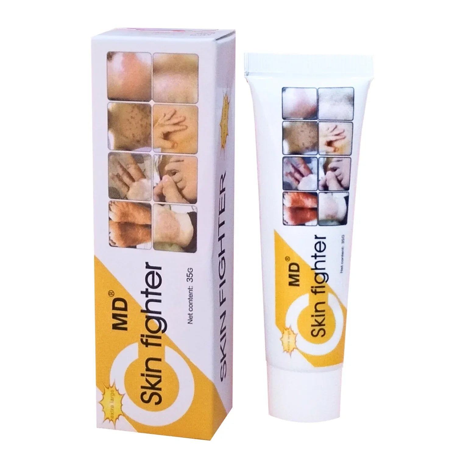 MD Skin Fighter Cream - 35g