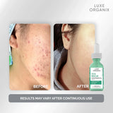Luxe Organix Cica Rescue Gentle Brightening Serum - 30ml