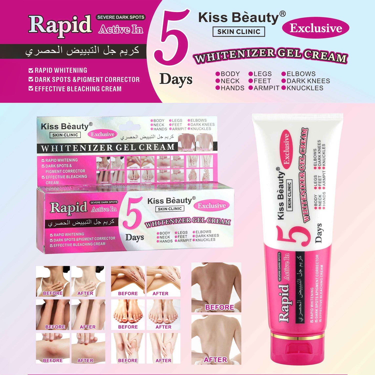 Kiss Beauty Rapid Active Body Brightening Gel Cream - 120ml