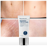 Vibrant Glamour Stretch Marks Remover Cream - 30g