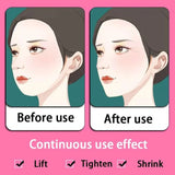 Silicone Perfect V Lifting Face Mask XC-801