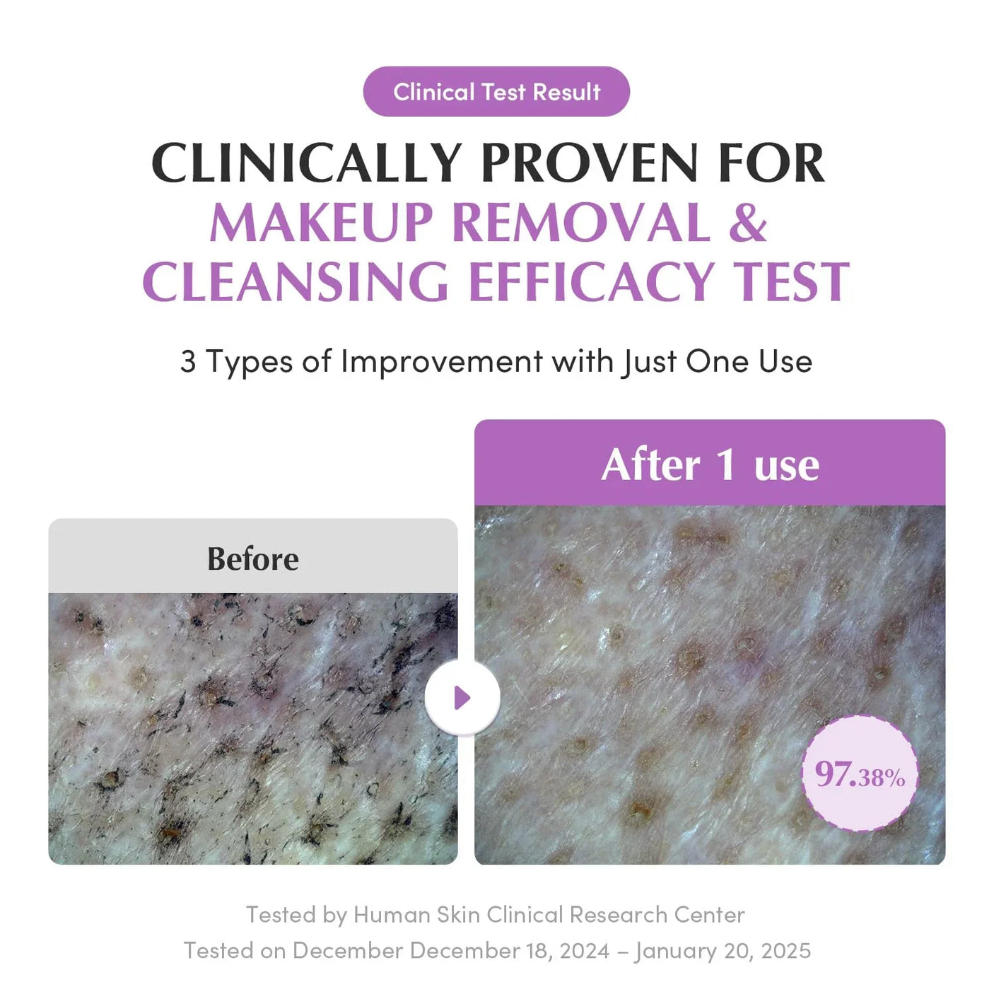 Eqqualberry Purple Rice Pore Smoothing Cleansing Oil - 200ml