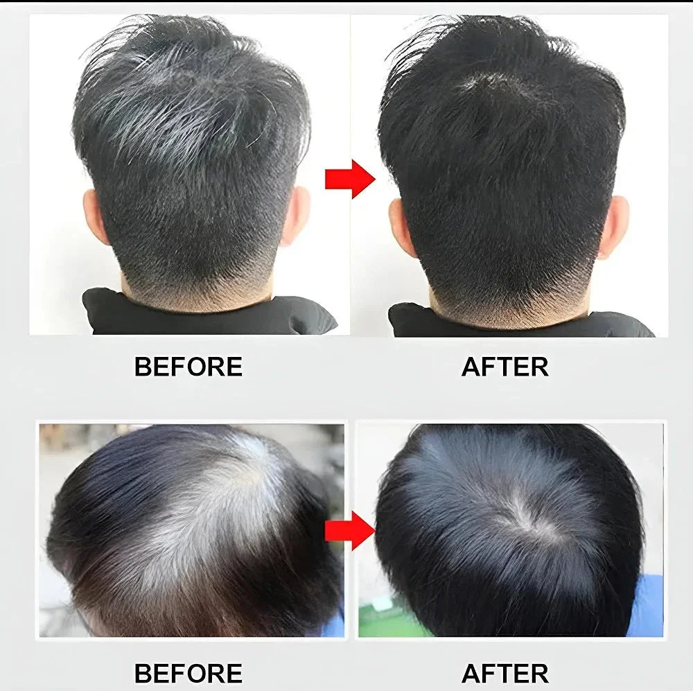 Apple Ammonia Free Black Hair Cream 72H - 500ml+500ml