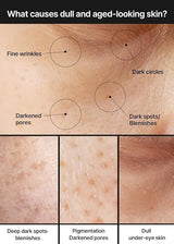 Celimax Pore+Dark Spot Brightening Cream - 35ml