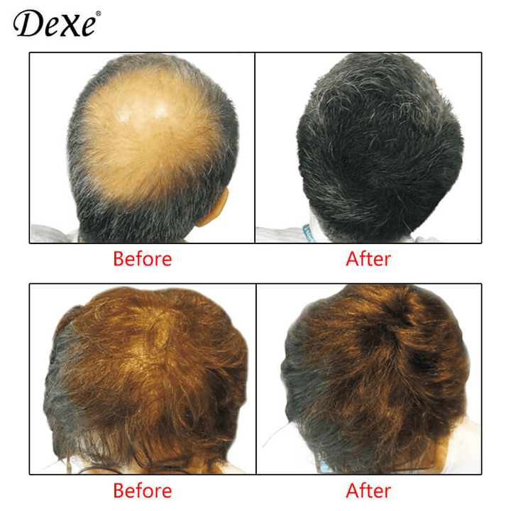 Dexe Hair Building Fibers Dark Brown No.2 - 22g - Pinoyhyper