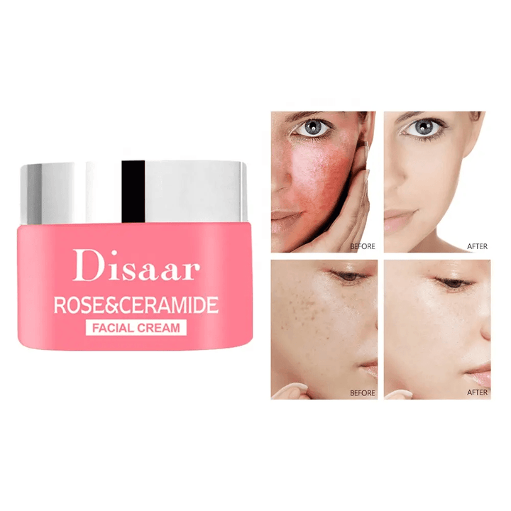 Disaar Rose Ceramide Facial Cream - 50g - Pinoyhyper