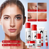 Sadoer Kojic Acid Anti-Freckles - 6 Pcs Set