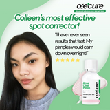 Oxecure Acne Clear Potion - 15ml
