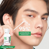 Oxecure Acne Clear Potion - 15ml