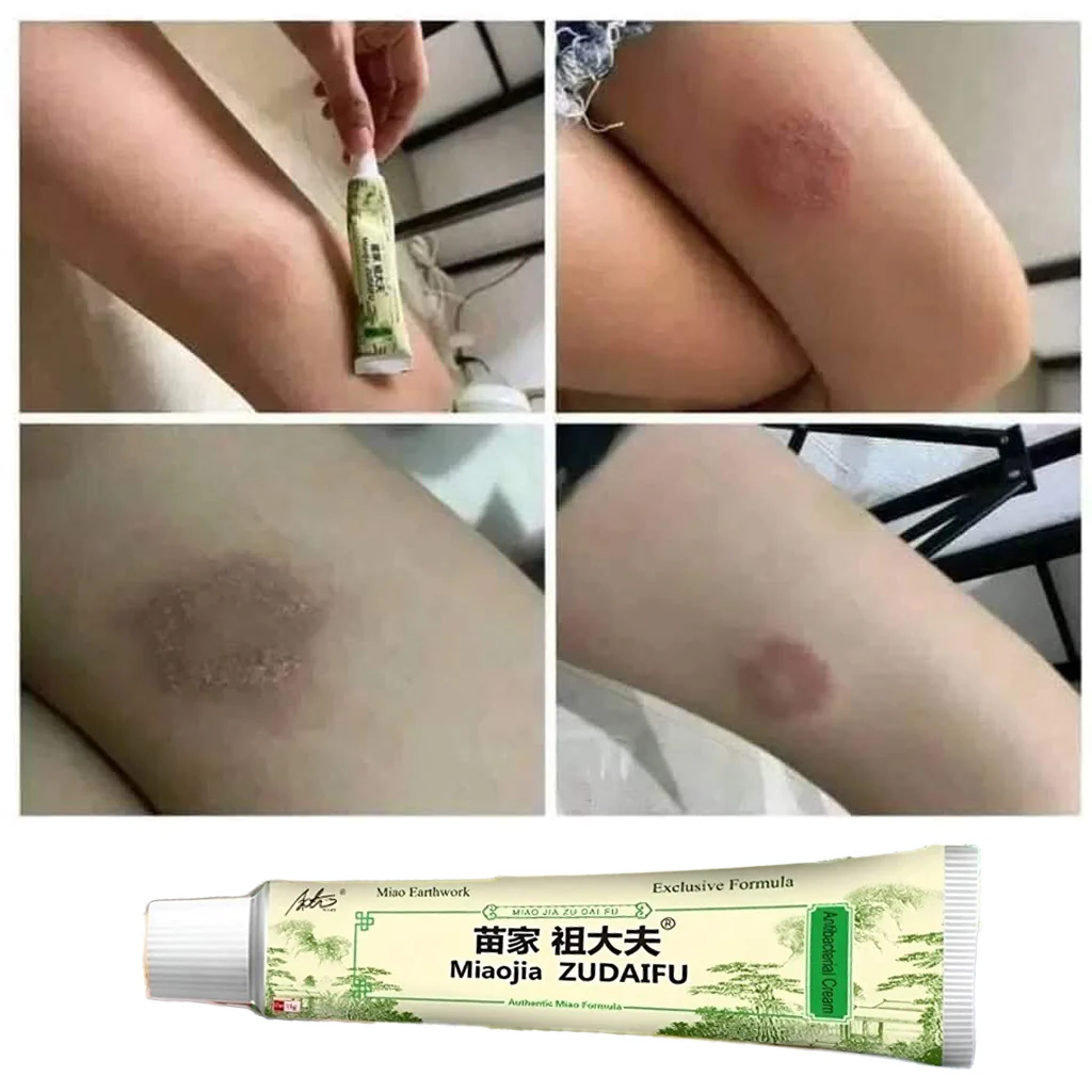 Miaojia Zudaifu Chinese Moisturizing Soothing Cream - 15g