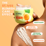 St. Ives Blemish Care 2% Salicylic Acid & Apricot Creamy Scrub - 300g