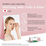 Oxecure Acne Clear Potion - 15ml