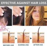 Maxfit Hair Growth Sakura Japanese Conditioner - 300ml