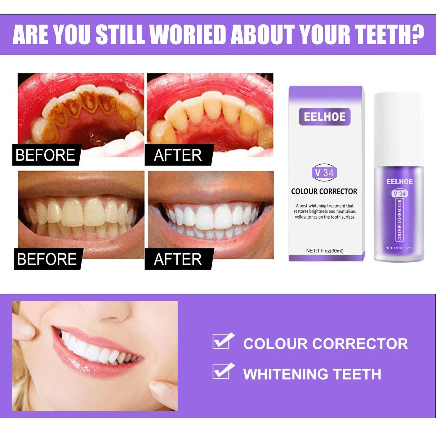 مصحح الألوان EELHOE V34 مصحح اللون + طقم العناية بالمينا NH pro Enamel Care - 30 مل × 2 قطعة