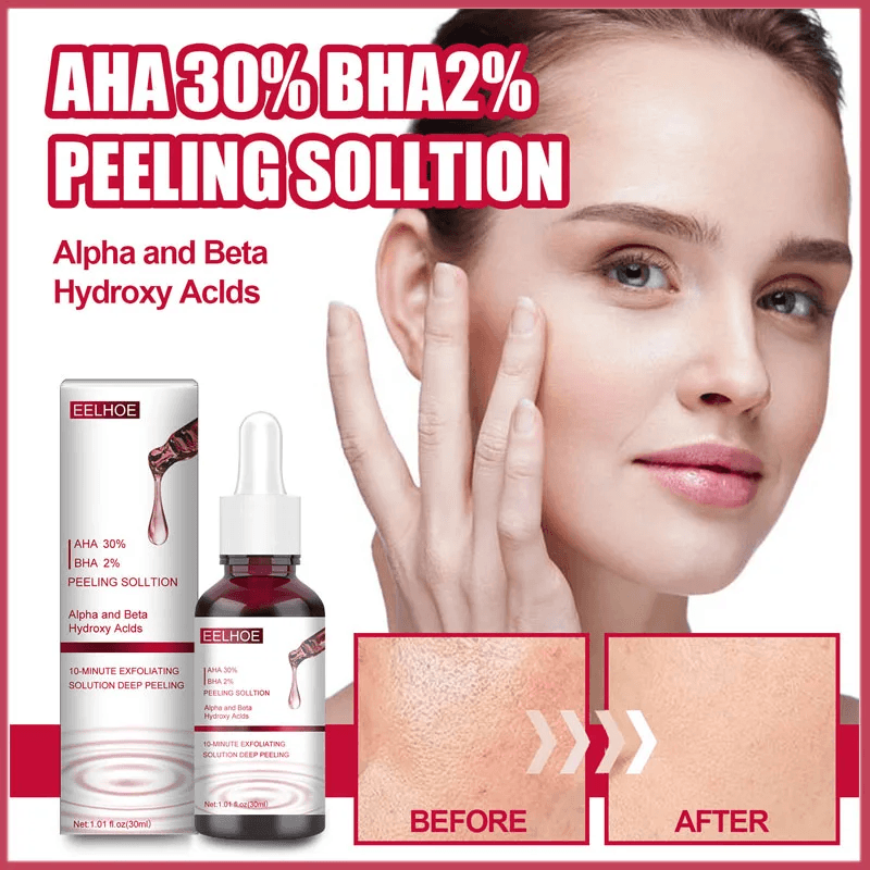 EELHOE AHA 30% + BHA 2% Peeling Solution - 30ml
