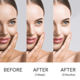 Kojie San Skin Lightening Kojic Acid Soap 3 Bars 100gm × 2 Pcs (Offer)