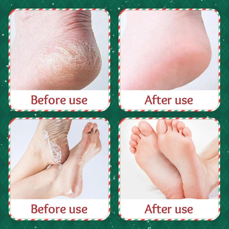 Sadoer Exfoliating & Brightening Hand & Foot Mask - 35g × 2 Pcs