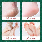Sadoer Exfoliating & Brightening Hand & Foot Mask - 35g × 2 Pcs