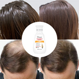 Disaar Rosemary & Peppermint Hair Growth Shampoo - 250ml