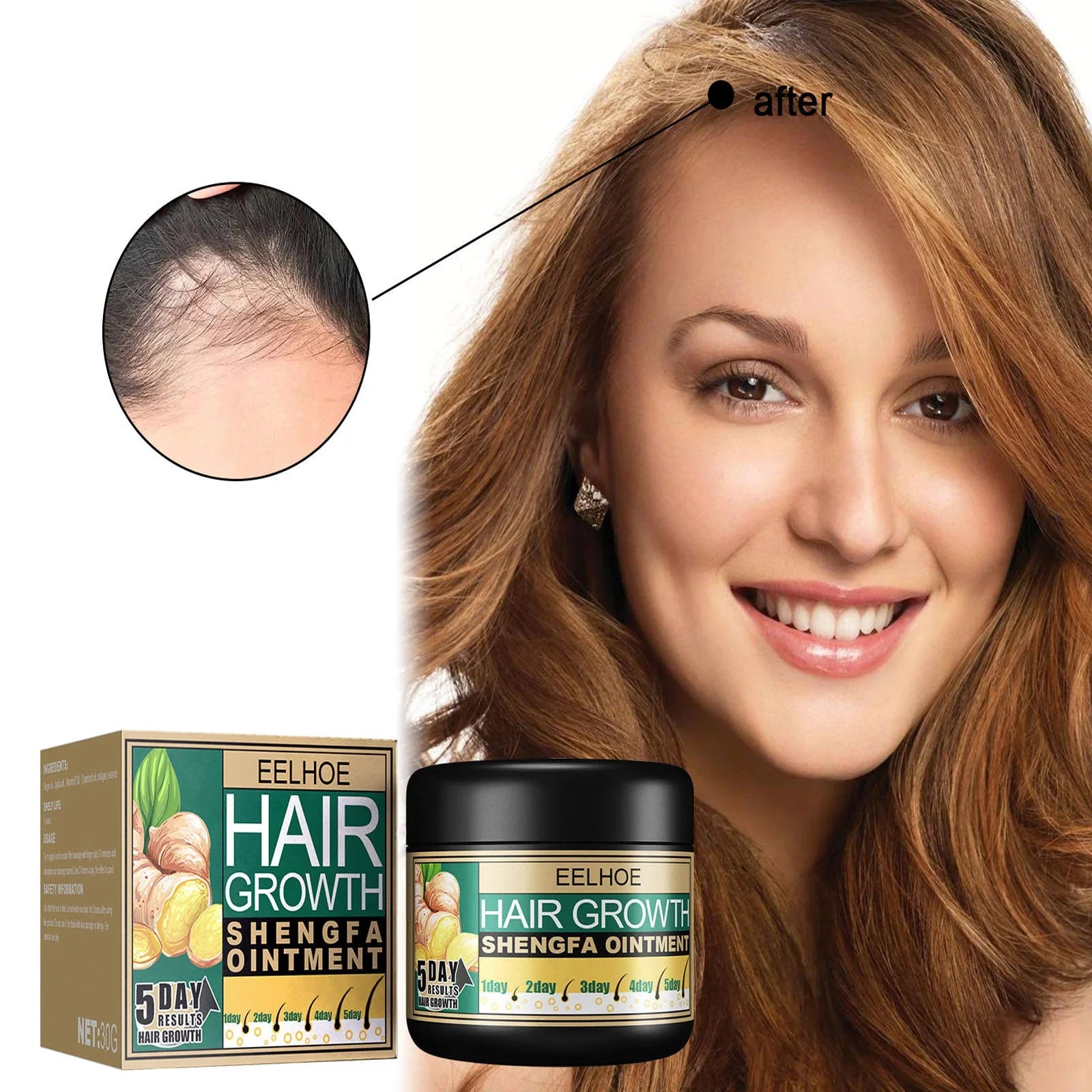 EELHOE Hair Growth Shengfa Cream - 100g