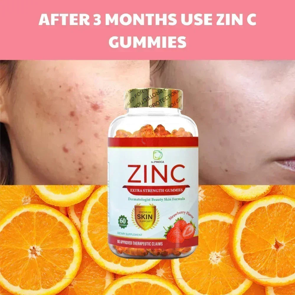 Dr. Pinoca Zinc Extra Strength Gummies Strawberry Flavour - 60 Gummies