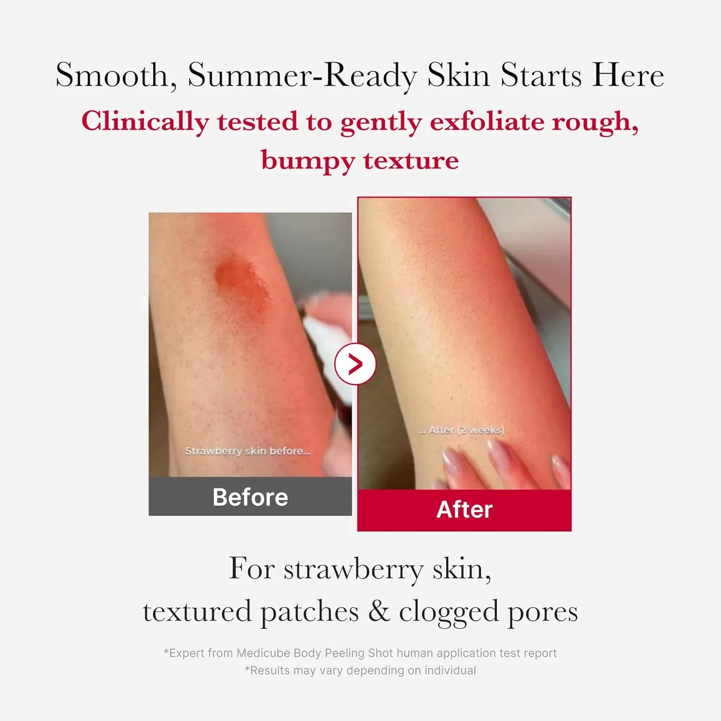 Medicube Red Acne Body Peeling Shot - 110g