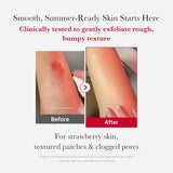 Medicube Red Acne Body Peeling Shot - 110g