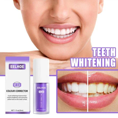 مصحح الألوان EELHOE V34 مصحح اللون + طقم العناية بالمينا NH pro Enamel Care - 30 مل × 2 قطعة
