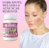 Supreme Gluta White I50000