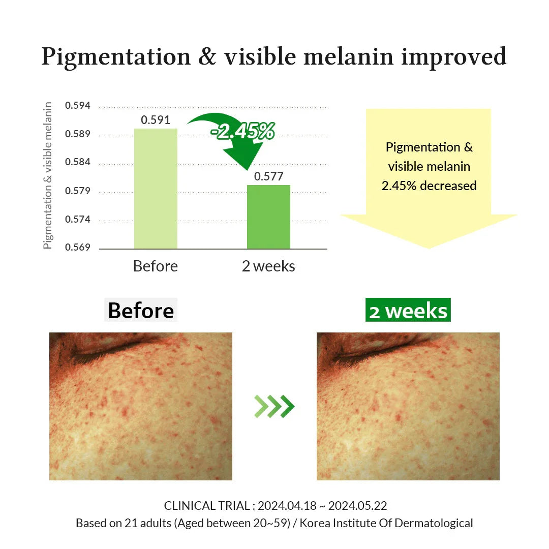 Dr. Althea Gentle Vitamin C Serum - 30ml