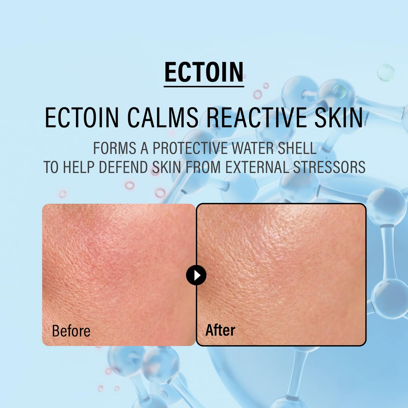 epii Ectoin & Panthenol Double Up Face Cream - 50ml