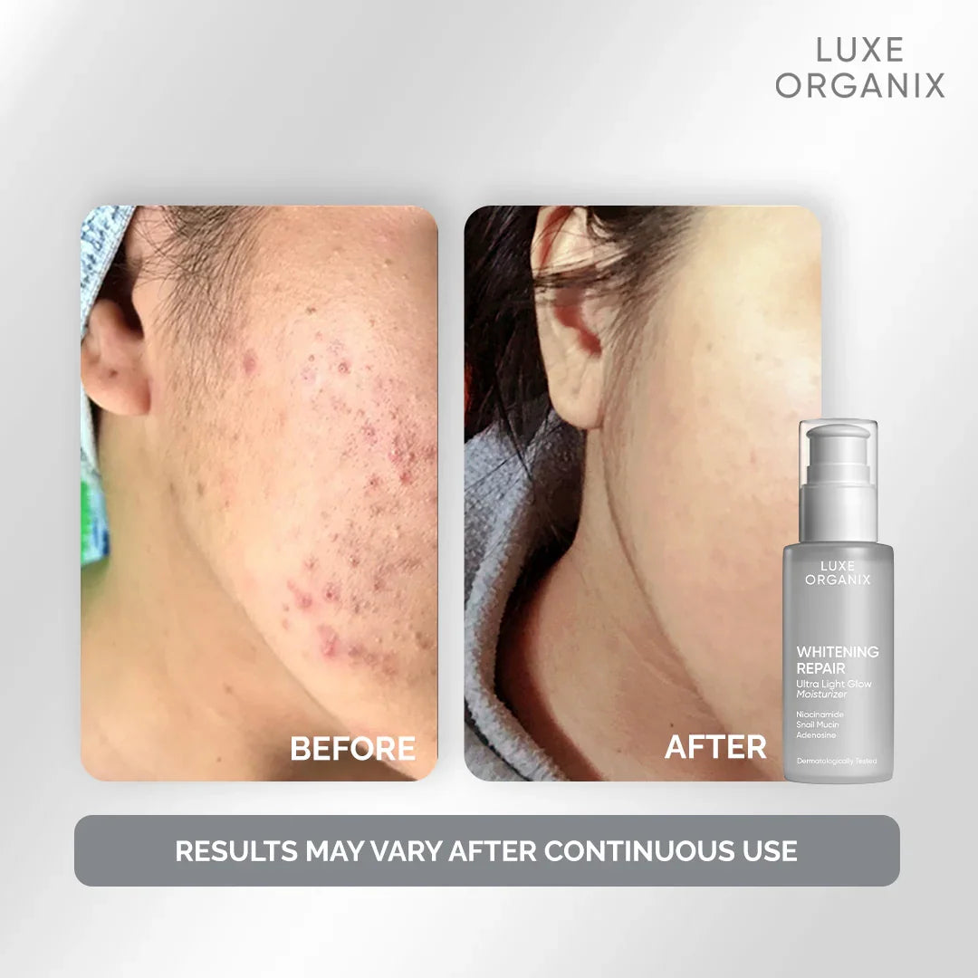 Luxe Organix Brightening Repair Ultra Light Glow Moisturizer - 80ml