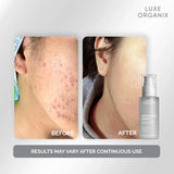 Luxe Organix Brightening Repair Ultra Light Glow Moisturizer - 80ml