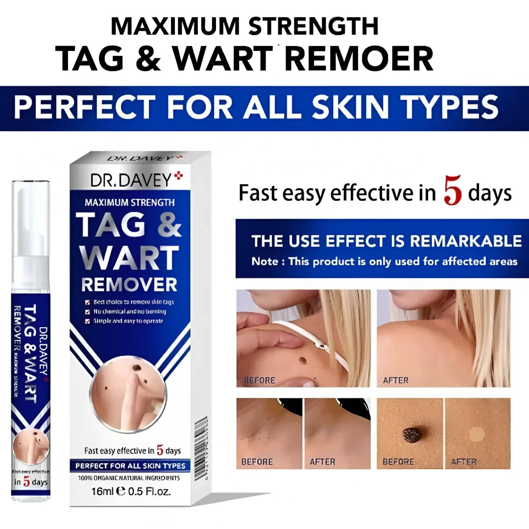 Dr. Davey Maximum Strength Tag & Wart Remover - 16ml