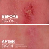 La Roche-Posay Cicaplast Baume B5+ For Dry Skin Irritations- 40ml