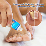 Sumifun Nail Fungus Care Cream - 20g