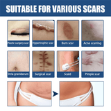 EELHOE Scars Eraser - 30g
