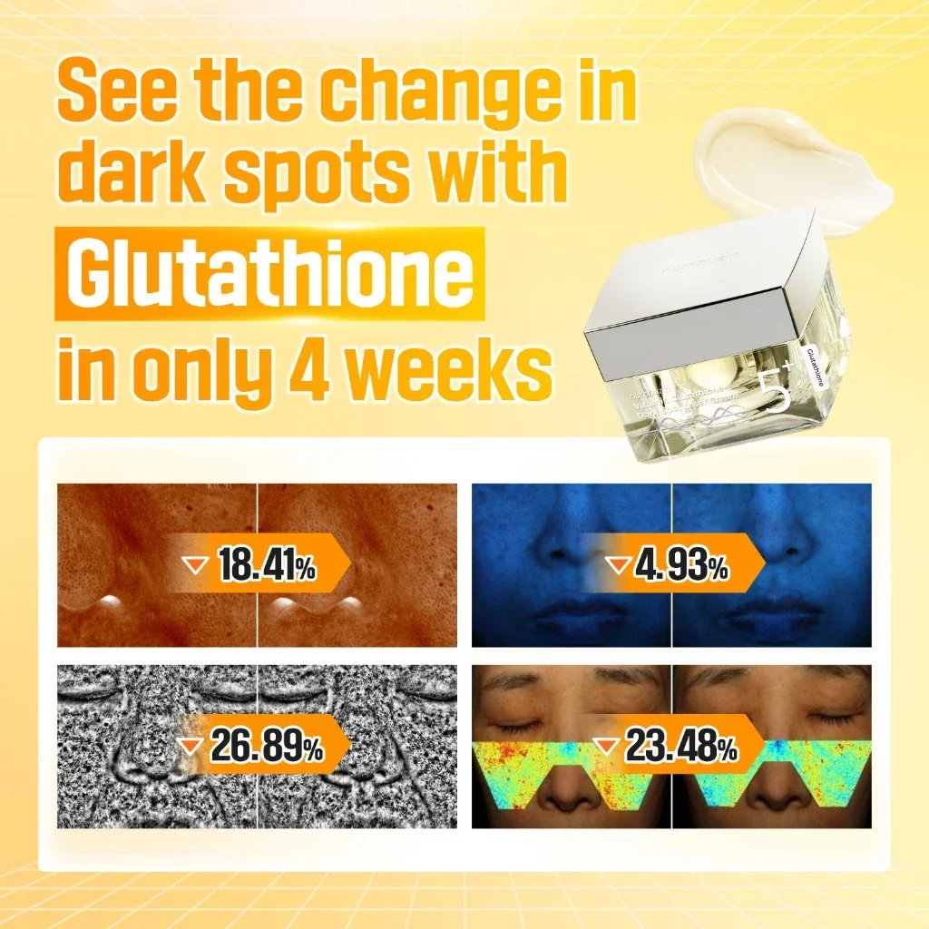 Numbuzin No.5 Vitamin Glutathione Dark Spot Laser Cream - 50ml