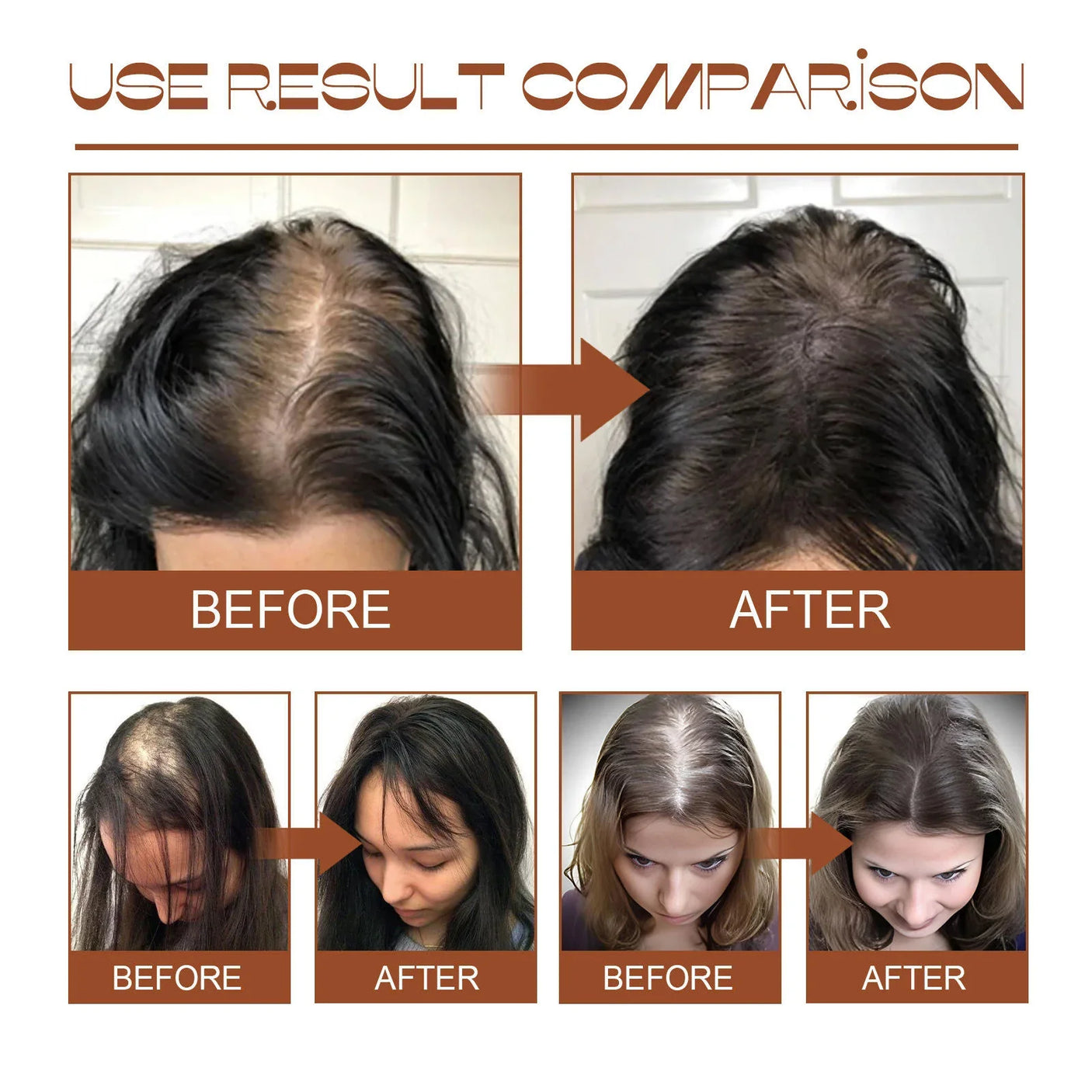 Eelhoe Batana Oil For Revitalized Hair Growth & Strength - 120ml