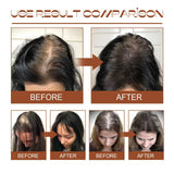 Eelhoe Batana Oil For Revitalized Hair Growth & Strength - 120ml