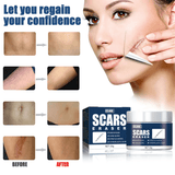 EELHOE Scars Eraser - 30g